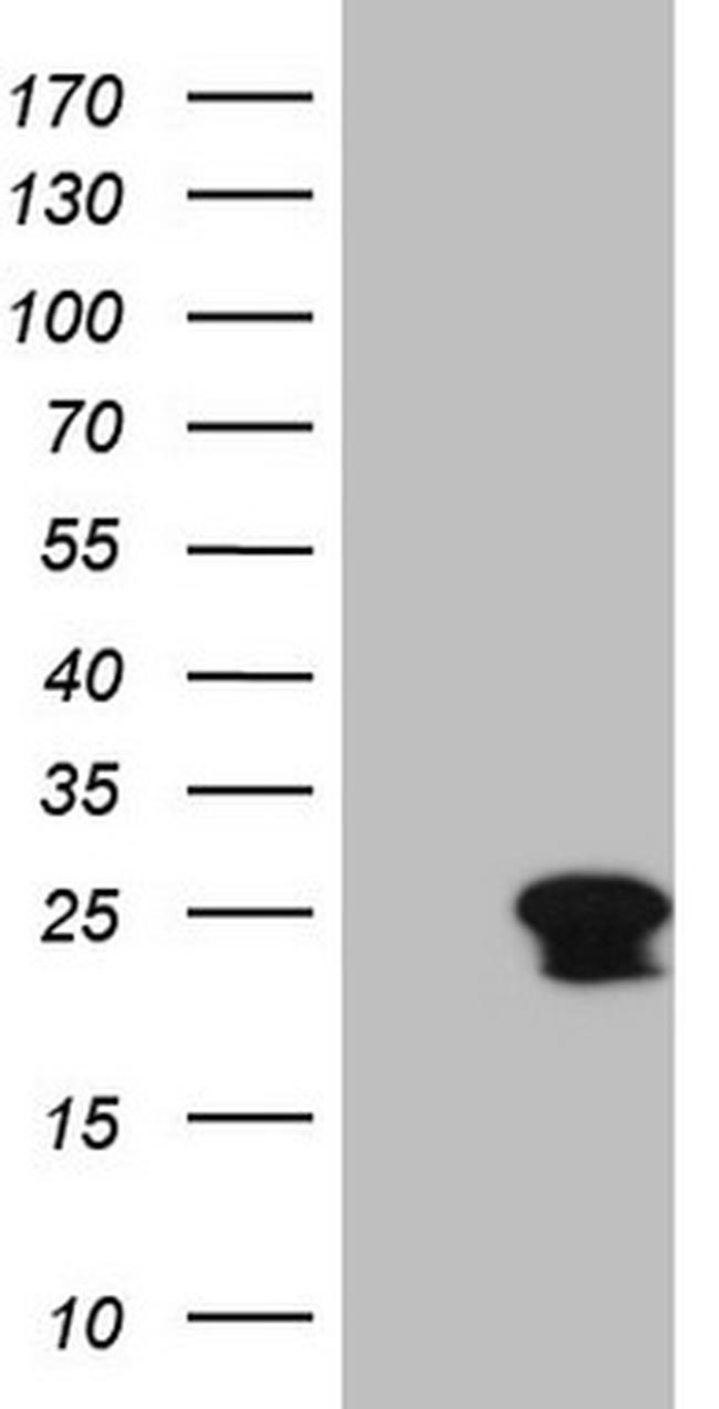TNFRSF18 Antibody in Western Blot (WB)