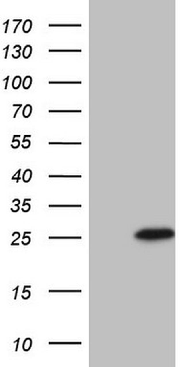 TNFRSF18 Antibody in Western Blot (WB)