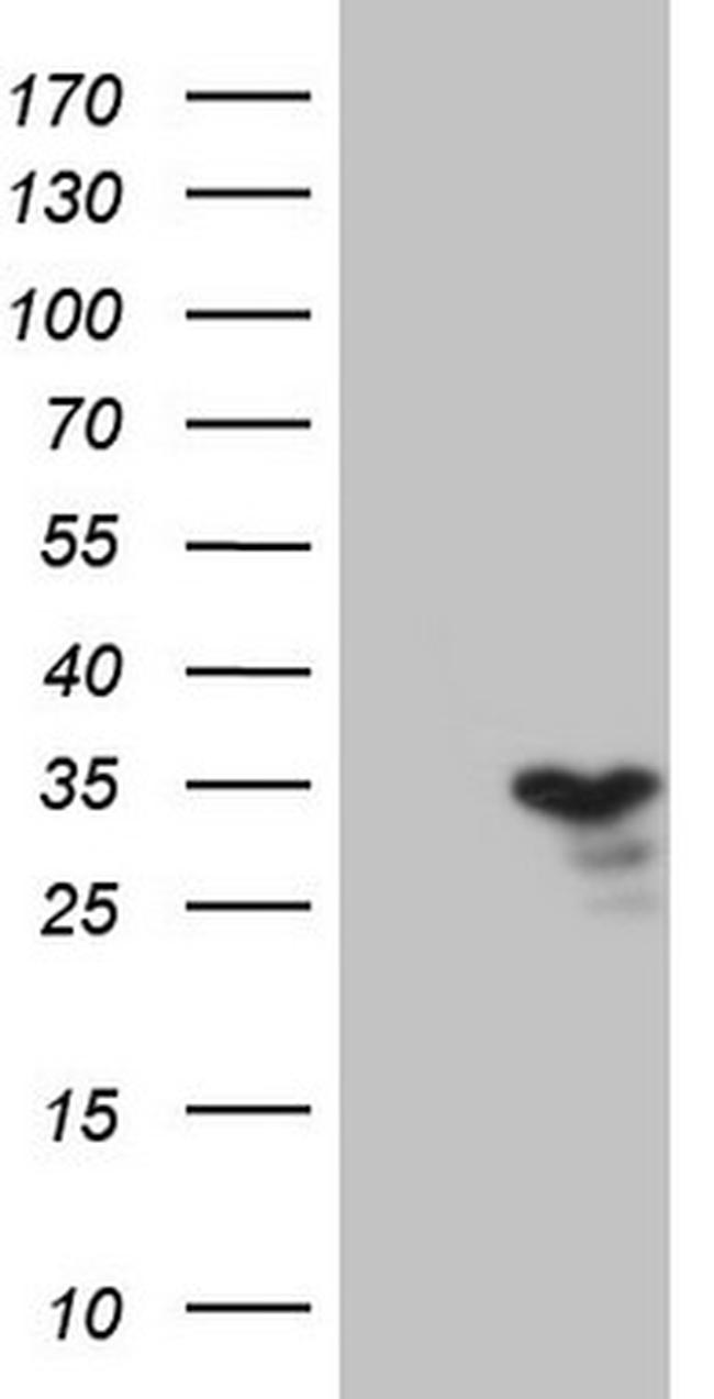 TNFRSF18 Antibody in Western Blot (WB)