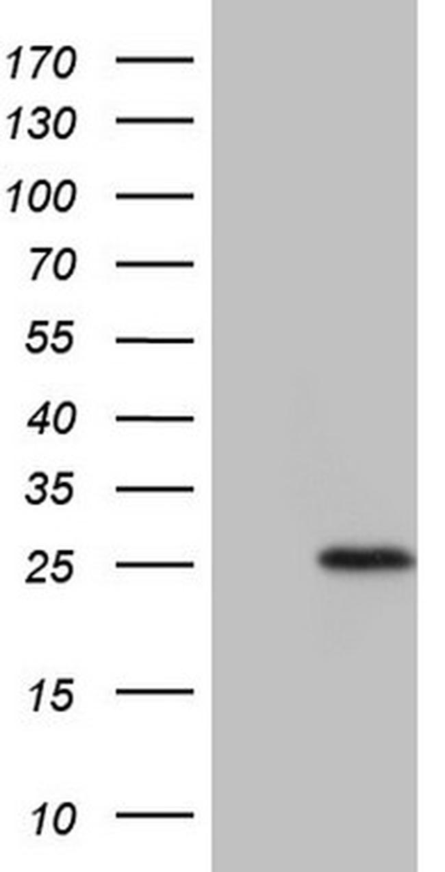 TNFRSF18 Antibody in Western Blot (WB)