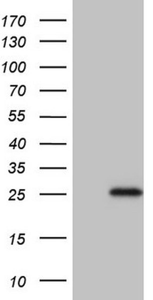 TNFRSF18 Antibody in Western Blot (WB)