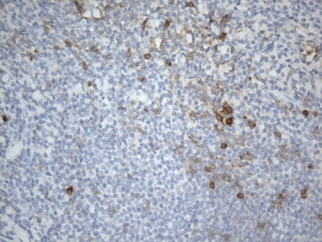 TNFRSF4 Antibody in Immunohistochemistry (Paraffin) (IHC (P))