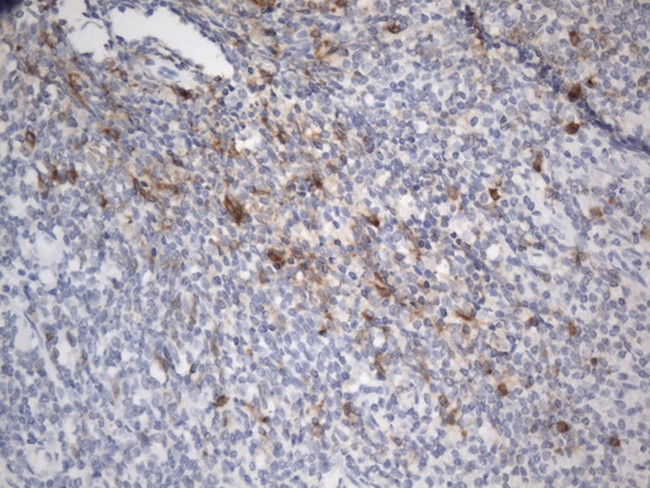 TNFRSF4 Antibody in Immunohistochemistry (Paraffin) (IHC (P))