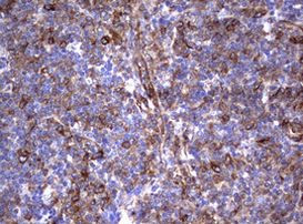 TNFRSF8 Antibody in Immunohistochemistry (Paraffin) (IHC (P))