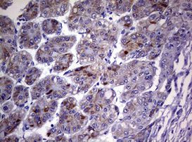 TNFRSF8 Antibody in Immunohistochemistry (Paraffin) (IHC (P))