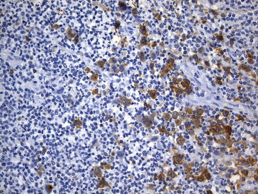 TNFRSF8 Antibody in Immunohistochemistry (Paraffin) (IHC (P))