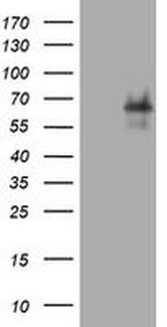 TNFRSF8 Antibody in Western Blot (WB)