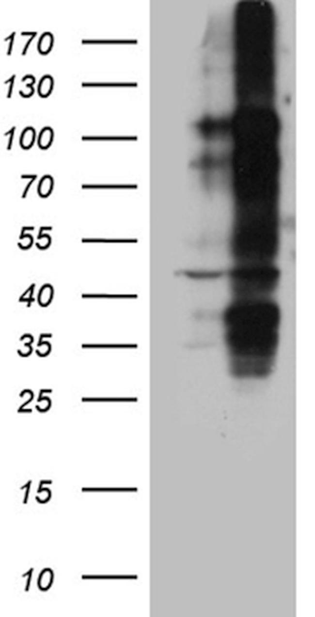 TNFRSF8 Antibody in Western Blot (WB)