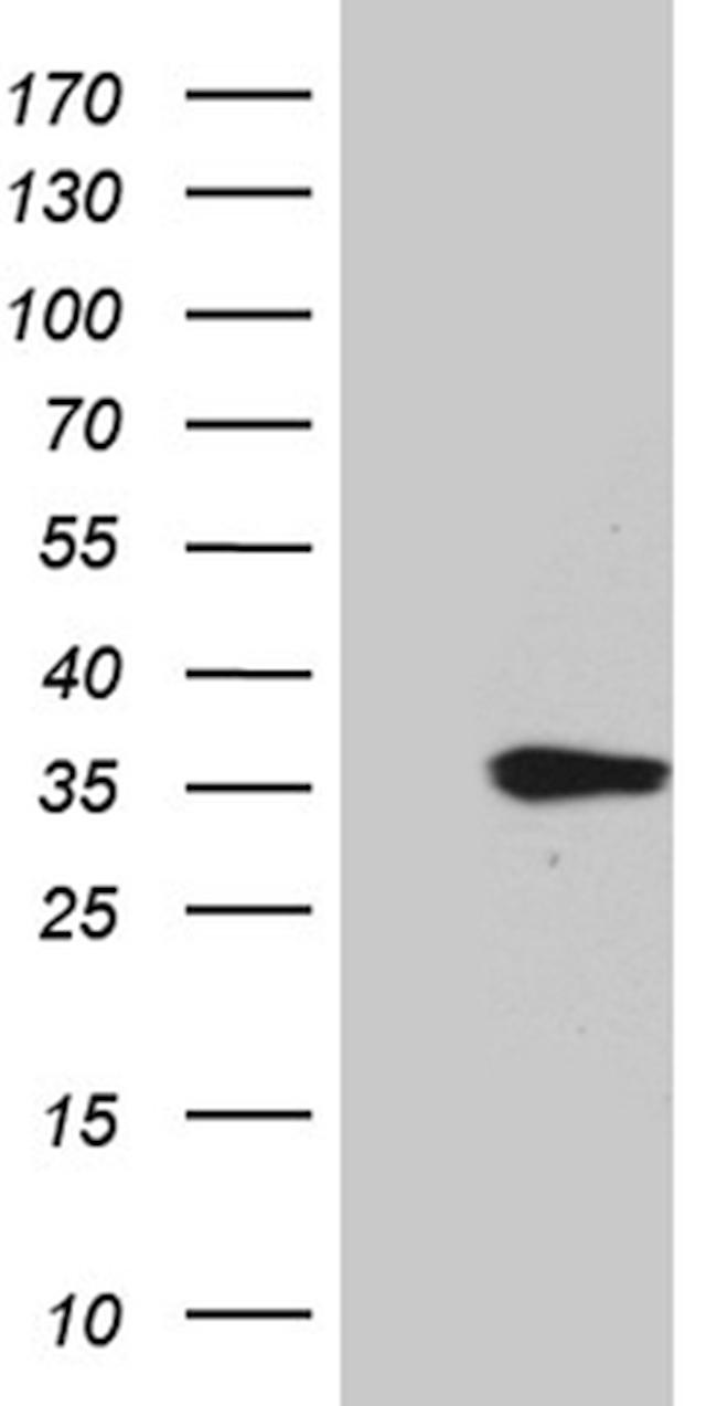 TNFSF10 Antibody in Western Blot (WB)