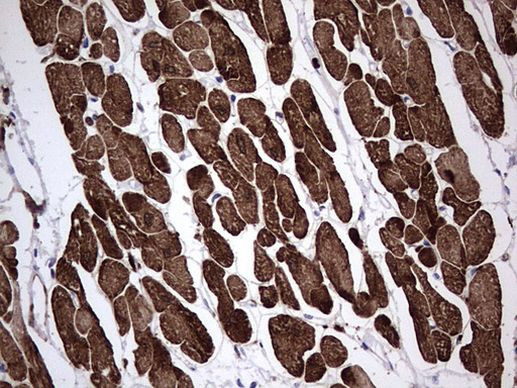 TNNC1 Antibody in Immunohistochemistry (Paraffin) (IHC (P))