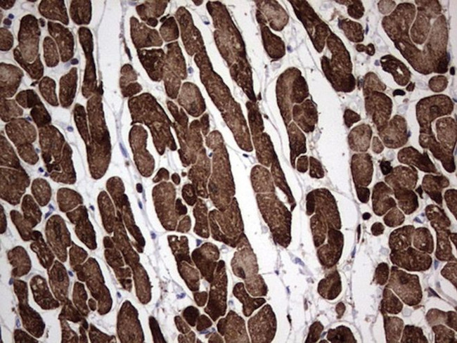 TNNC1 Antibody in Immunohistochemistry (Paraffin) (IHC (P))