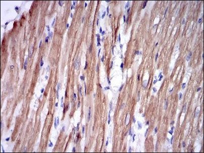 TNNI2 Antibody in Immunohistochemistry (Paraffin) (IHC (P))