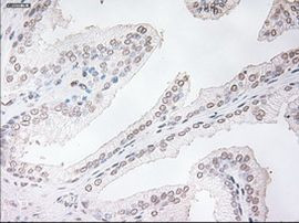 TNNI3 Antibody in Immunohistochemistry (Paraffin) (IHC (P))