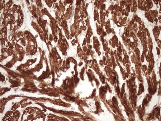 TNNI3 Antibody in Immunohistochemistry (Paraffin) (IHC (P))