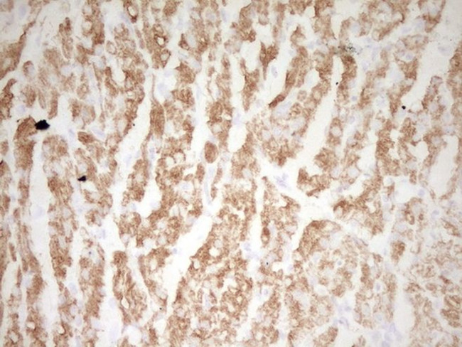 TNNI3 Antibody in Immunohistochemistry (Paraffin) (IHC (P))