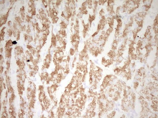 TNNI3 Antibody in Immunohistochemistry (Paraffin) (IHC (P))