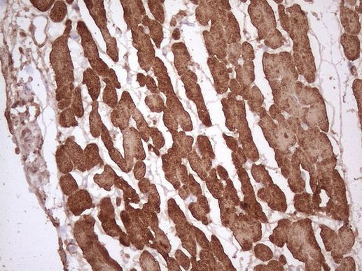 TNNI3 Antibody in Immunohistochemistry (Paraffin) (IHC (P))