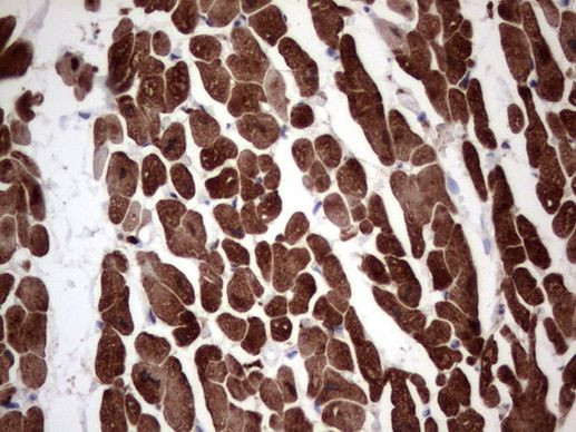 TNNT2 Antibody in Immunohistochemistry (Paraffin) (IHC (P))