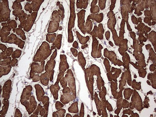 TNNT2 Antibody in Immunohistochemistry (Paraffin) (IHC (P))