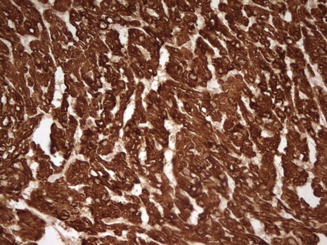 TNNT2 Antibody in Immunohistochemistry (Paraffin) (IHC (P))