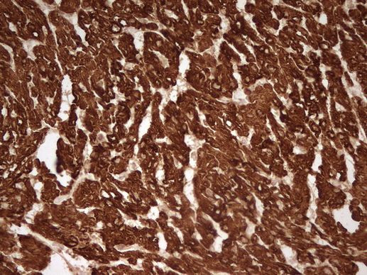 TNNT2 Antibody in Immunohistochemistry (Paraffin) (IHC (P))