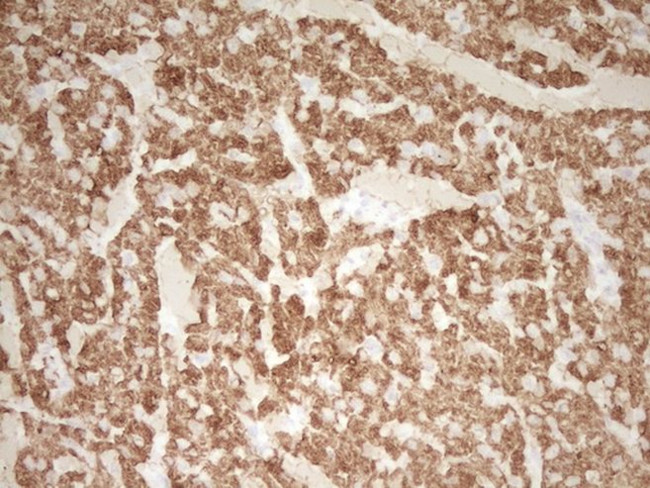 TNNT2 Antibody in Immunohistochemistry (Paraffin) (IHC (P))