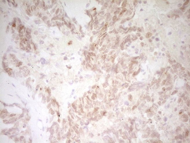 TNNT2 Antibody in Immunohistochemistry (Paraffin) (IHC (P))