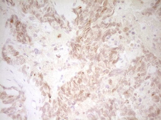 TNNT2 Antibody in Immunohistochemistry (Paraffin) (IHC (P))