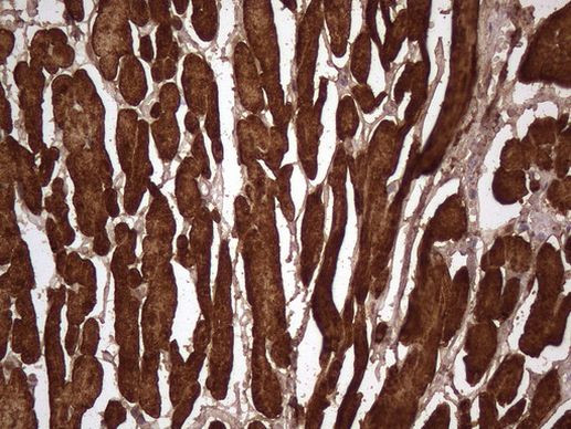 TNNT2 Antibody in Immunohistochemistry (Paraffin) (IHC (P))