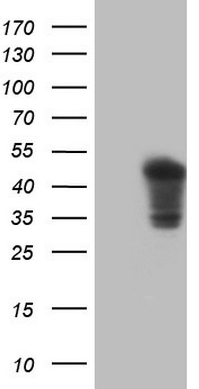 TNNT2 Antibody in Western Blot (WB)