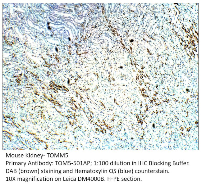 TOMM5 Antibody in Immunohistochemistry (IHC)