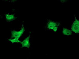 TOMM34 Antibody in Immunocytochemistry (ICC/IF)