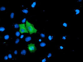 TOMM34 Antibody in Immunocytochemistry (ICC/IF)