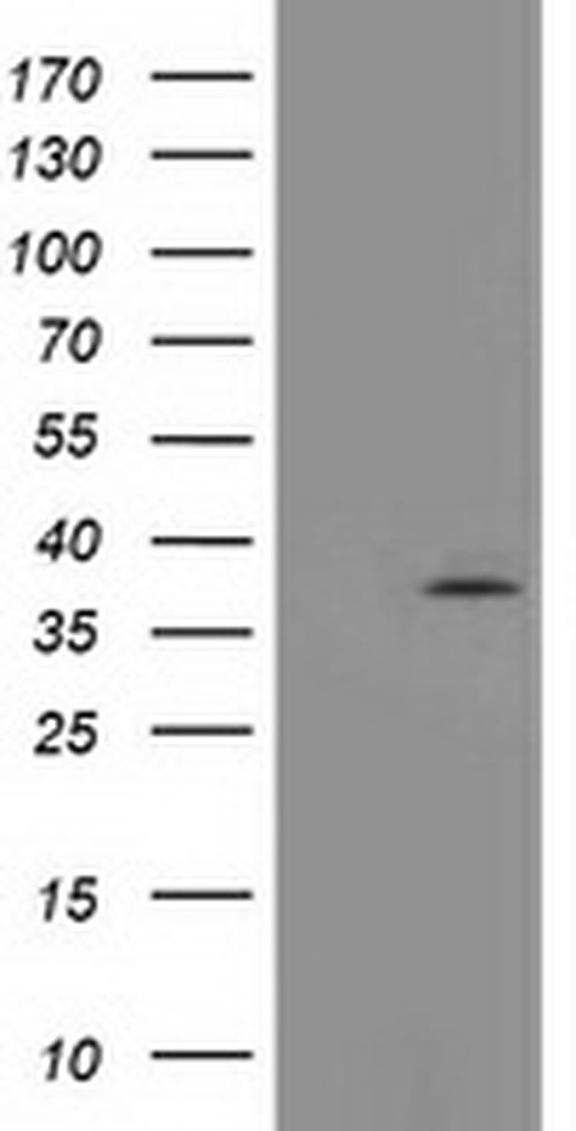 TOMM34 Antibody in Western Blot (WB)