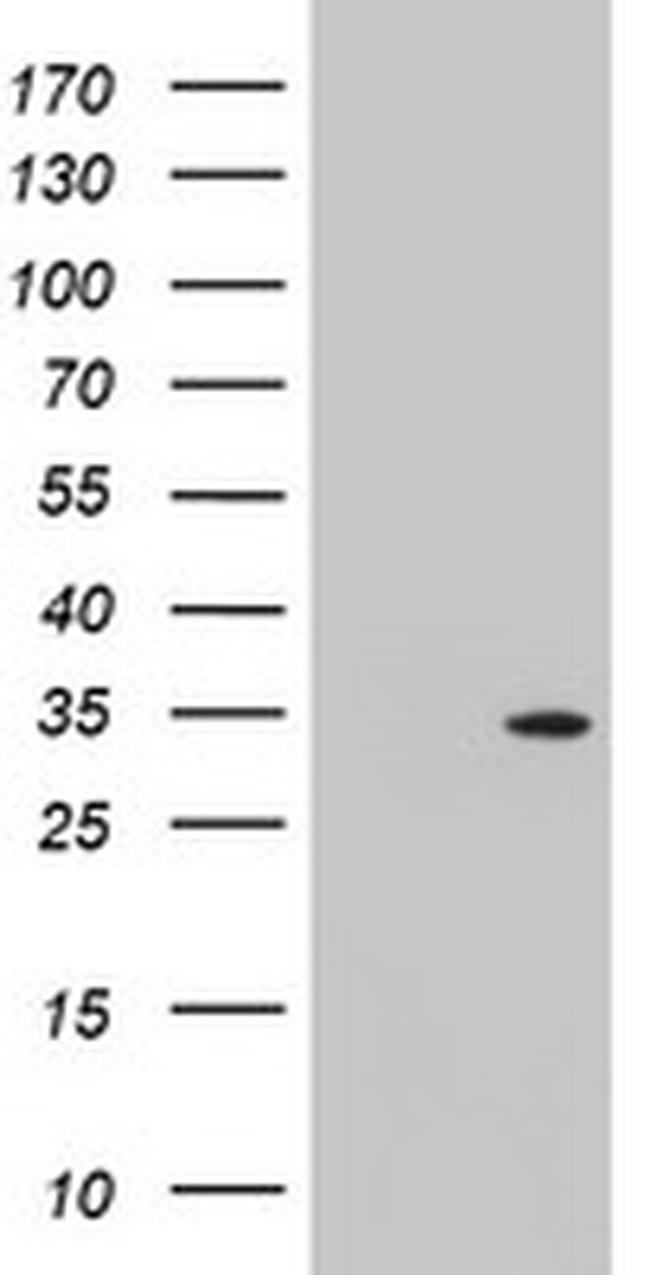 TOMM34 Antibody in Western Blot (WB)