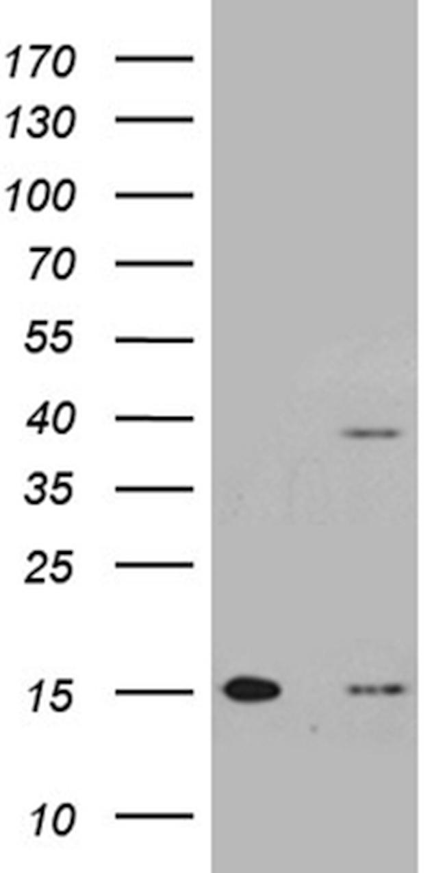 TOMM40L Antibody in Western Blot (WB)