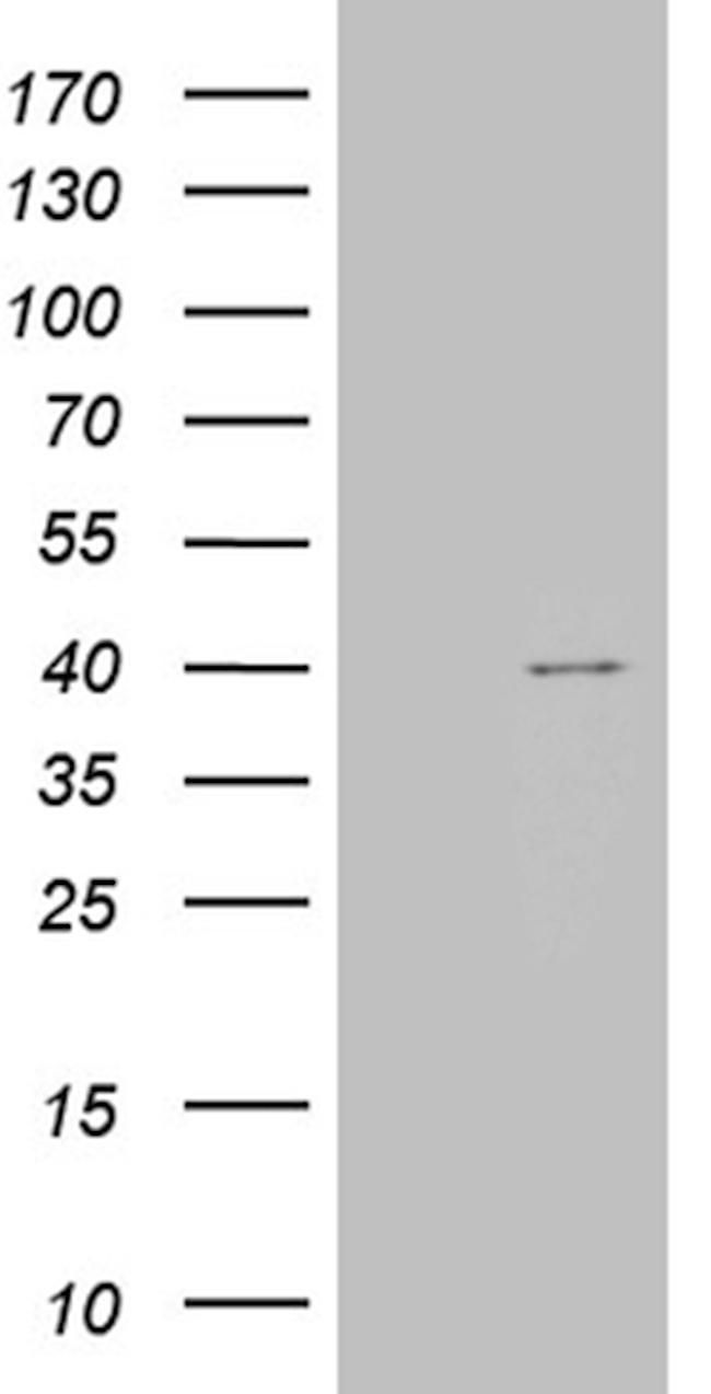 TOMM40L Antibody in Western Blot (WB)