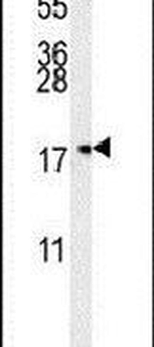 TOMM6 Antibody in Western Blot (WB)