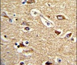 TOM70 Antibody in Immunohistochemistry (IHC)