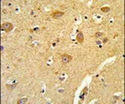 TOM70 Antibody in Immunohistochemistry (IHC)