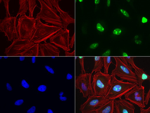TOP2A Antibody in Immunocytochemistry (ICC/IF)