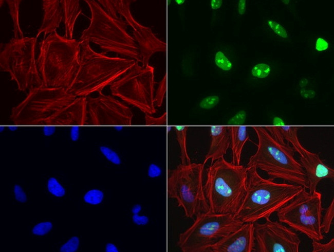 TOP2A Antibody in Immunocytochemistry (ICC/IF)