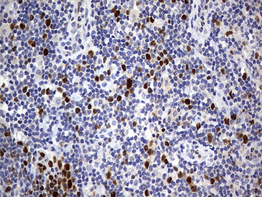 TOP2A Antibody in Immunohistochemistry (Paraffin) (IHC (P))