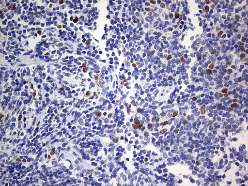 TOP2A Antibody in Immunohistochemistry (Paraffin) (IHC (P))