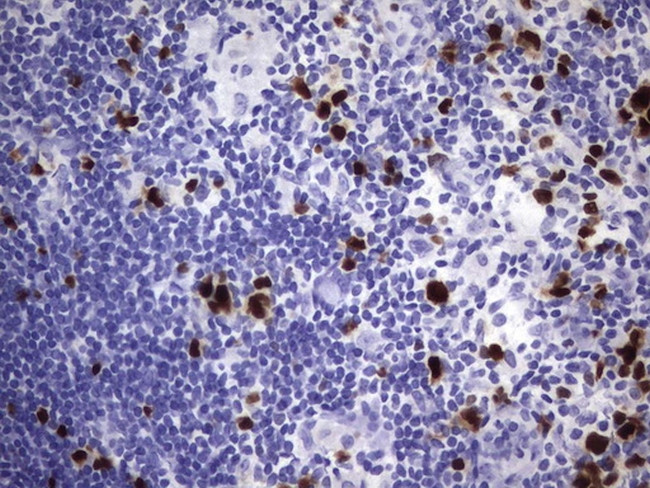 TOP2A Antibody in Immunohistochemistry (Paraffin) (IHC (P))