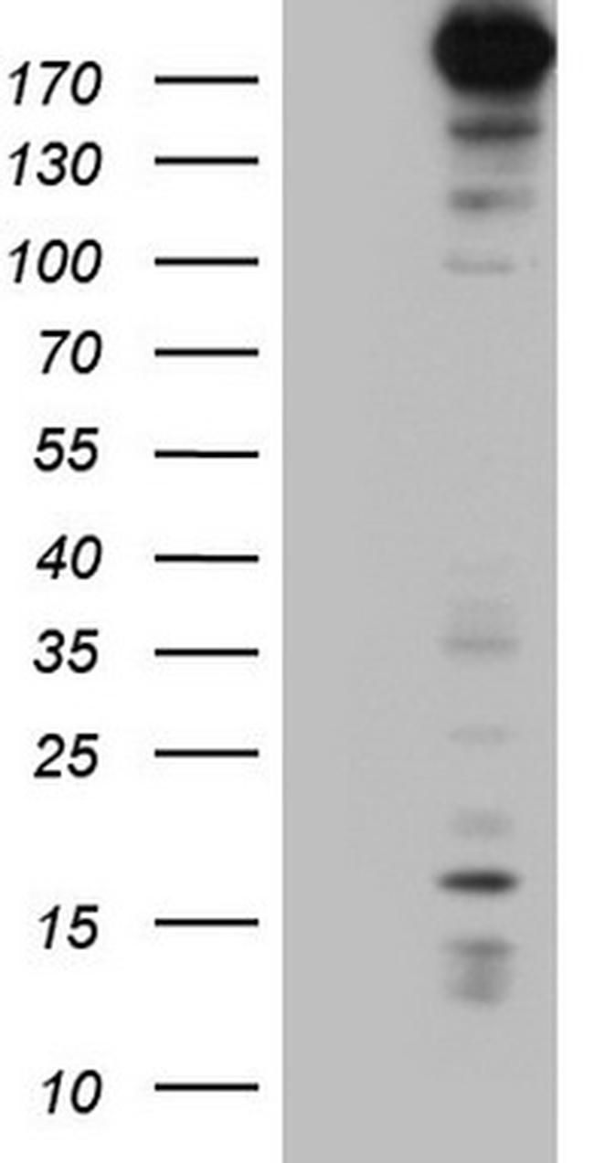 TOP2A Antibody in Western Blot (WB)