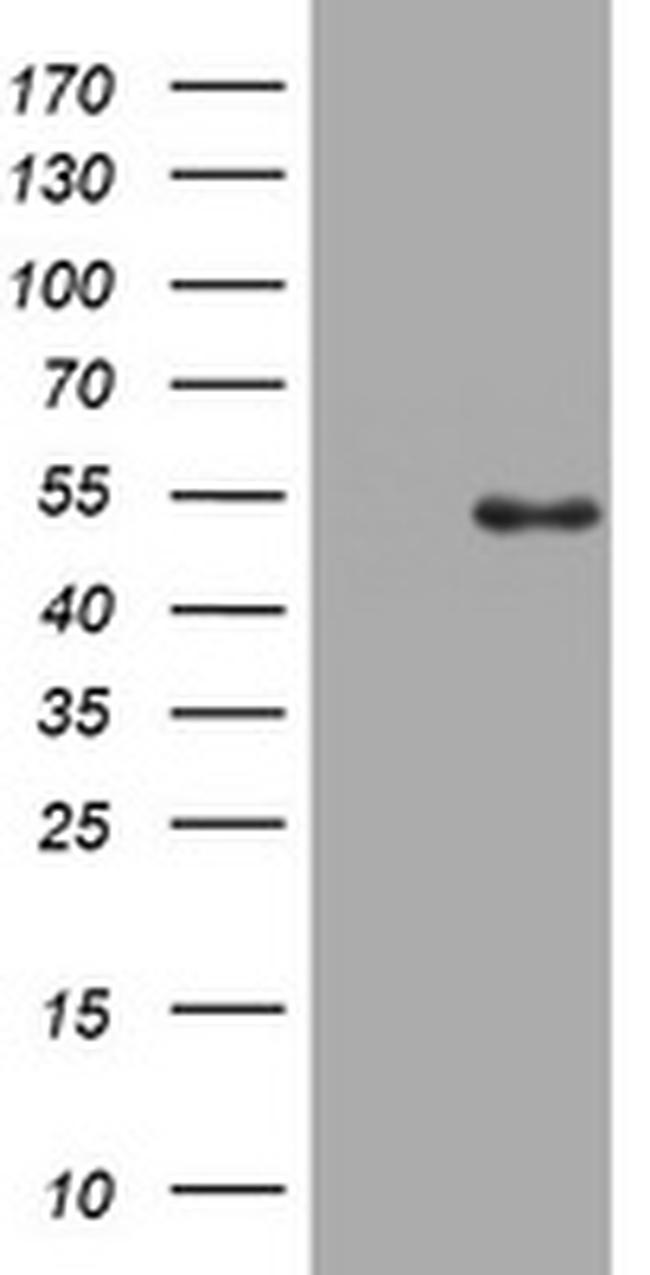 TOP2A Antibody in Western Blot (WB)