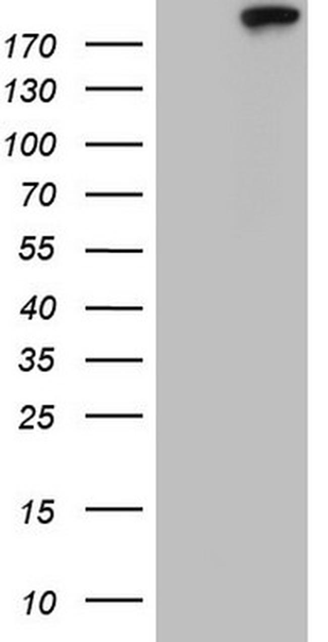 TOP2A Antibody in Western Blot (WB)