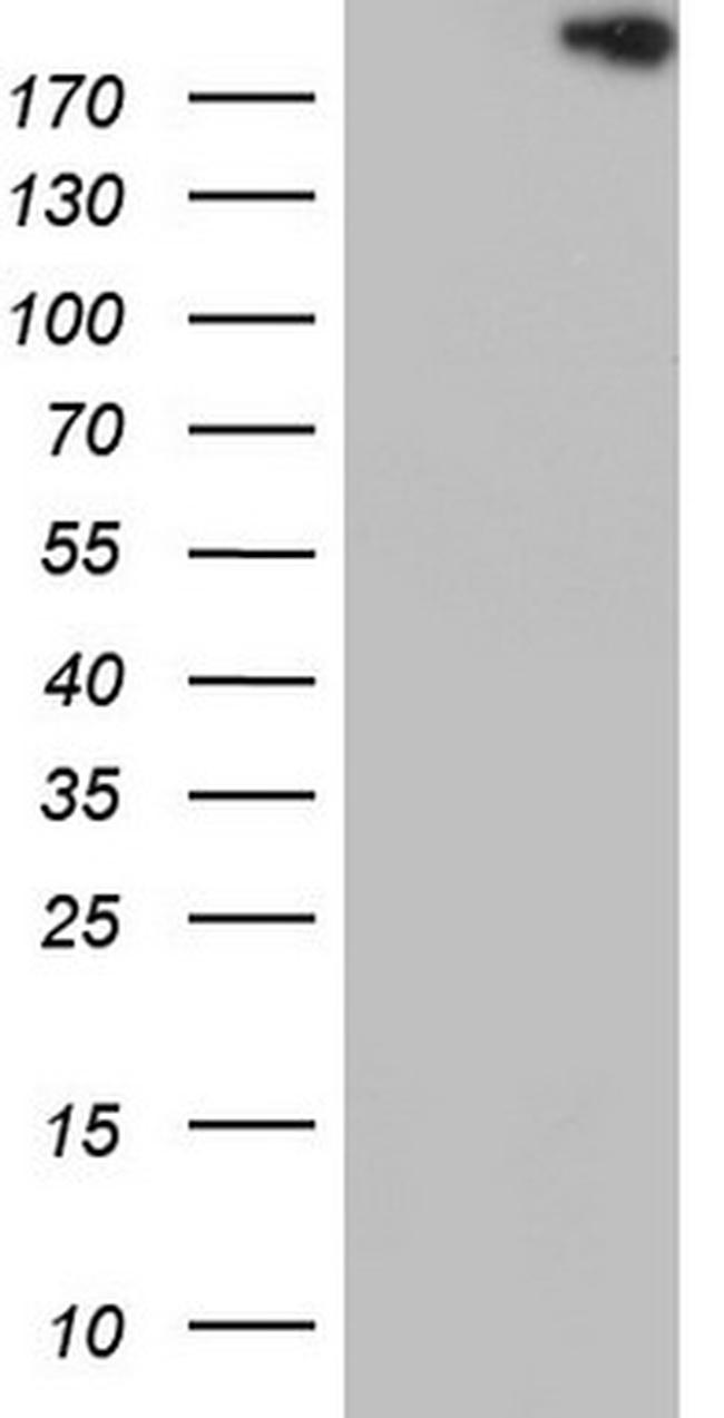 TOP2A Antibody in Western Blot (WB)