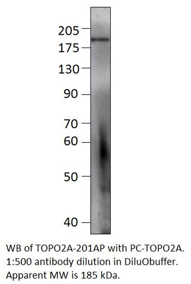 Topoisomerase II alpha Antibody in Western Blot (WB)